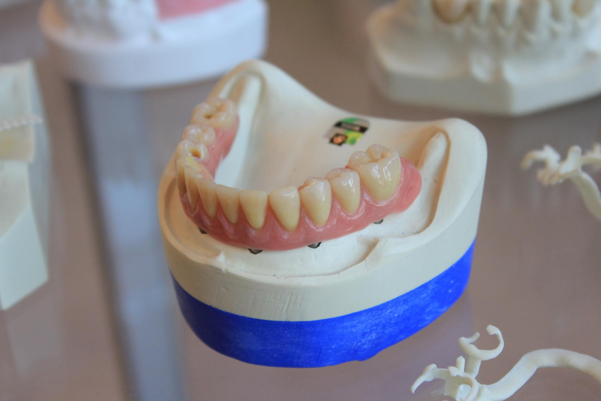 歯の詰め物が痛い 5つの原因と3つの対処法 総社市の歯医者 むかえ歯科