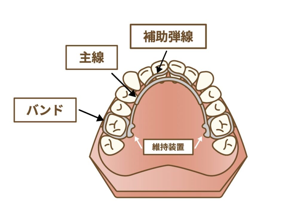 リンガルアーチ